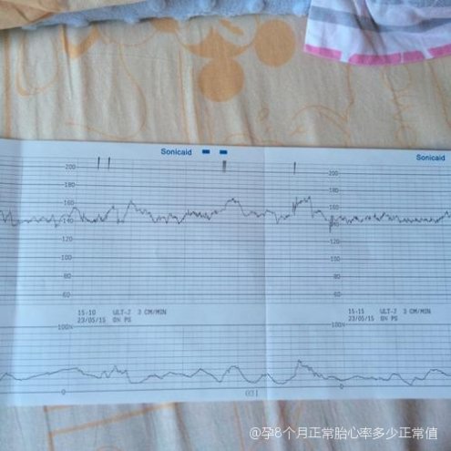 孕五个月胎心的正常数值及其重要性